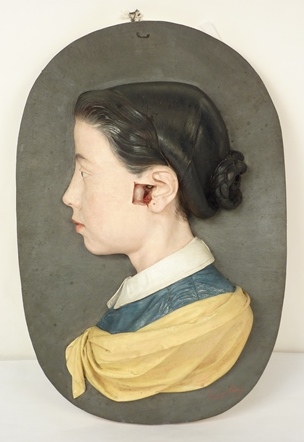 Bust de jove que serveix com a model anatòmic per representar la situació i aspecte extern de l'oïda interna.
Francisco Pérez Llorens i Juan Samsó Lengly
Barcelona, c. 1860